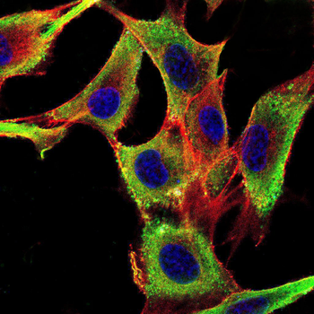 ROR2 Antibody