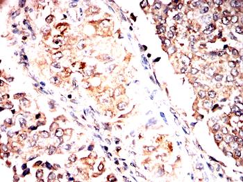 ROR2 Antibody