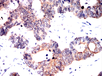 ROR2 Antibody