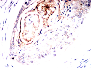ROR2 Antibody