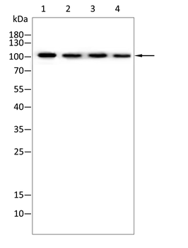 ROR2 Antibody