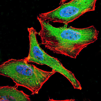 ROR2 Antibody
