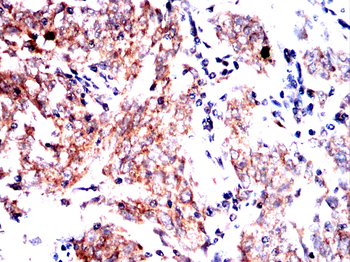 PLA2G12A Antibody