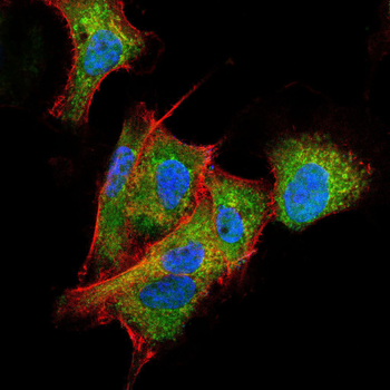ADD1 Antibody