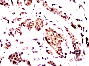 ADD1 Antibody