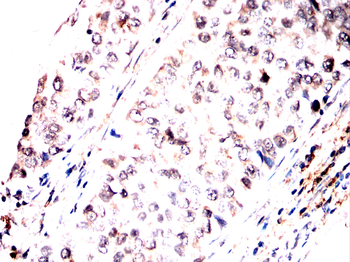ADD1 Antibody