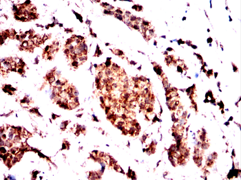 ADD1 Antibody