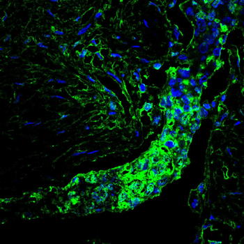 ADD1 Antibody