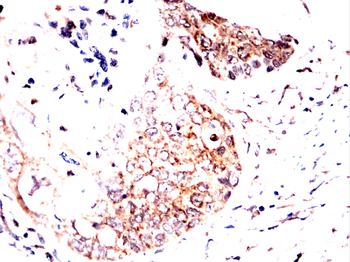 ADD1 Antibody