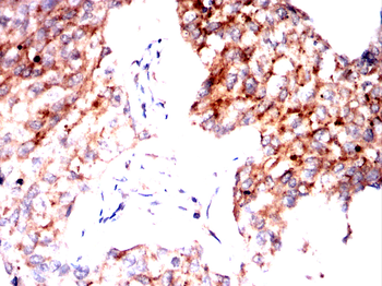 ADD1 Antibody
