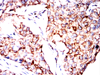 EZR Antibody