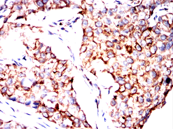 EZR Antibody