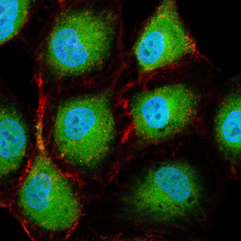MGMT Antibody