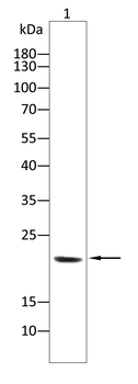 MGMT Antibody