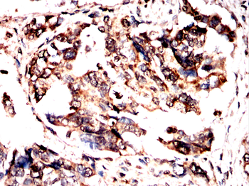 IRAK3 Antibody