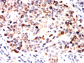 IRAK3 Antibody