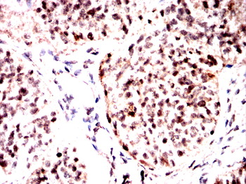IRAK3 Antibody