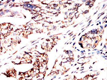 CSF3 Antibody