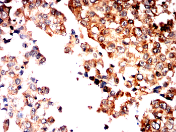 CSF3 Antibody