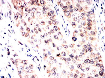 IRAK3 Antibody