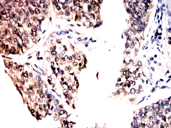 IRAK3 Antibody