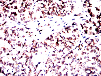 AIM2 Antibody