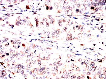 AIM2 Antibody