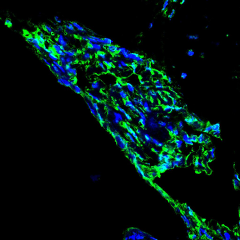 AIM2 Antibody