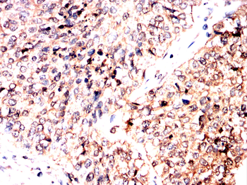 AIM2 Antibody