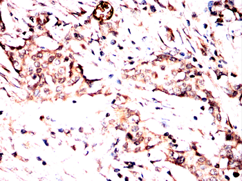 AIM2 Antibody