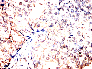 AIM2 Antibody