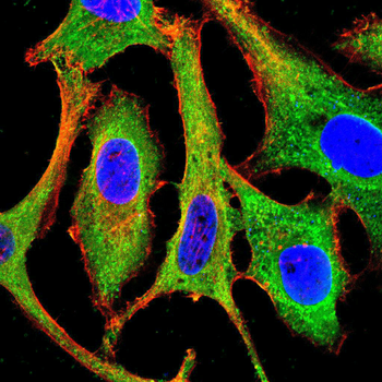 AIM2 Antibody