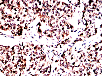 AIM2 Antibody