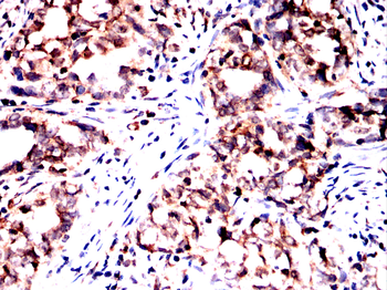 AIM2 Antibody