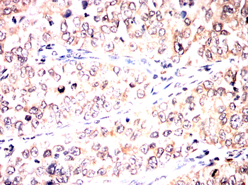 AIM2 Antibody