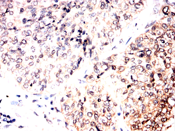 AIM2 Antibody