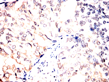 AIM2 Antibody
