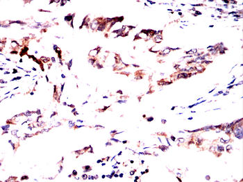 HMMR Antibody