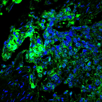 HMMR Antibody