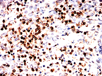 HMMR Antibody