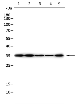 RAB8A Antibody