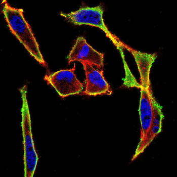 AKT Antibody