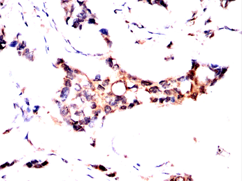 AKT Antibody