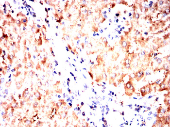 AKT Antibody