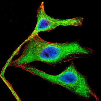 AKT Antibody