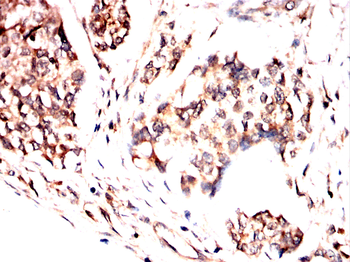 AKT Antibody