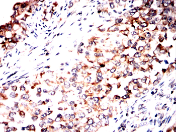 AKT Antibody