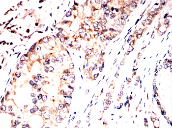 AKT Antibody