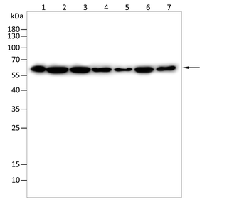 AKT Antibody
