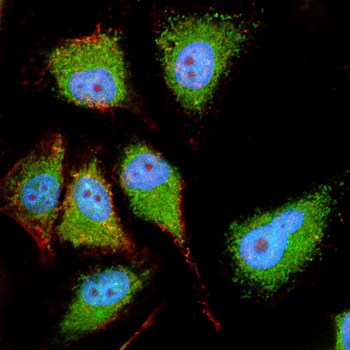 AKT Antibody